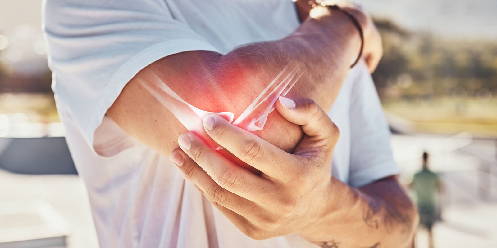 Medial and Lateral Epicondylitis: Understanding a Common Cause of Elbow Pain